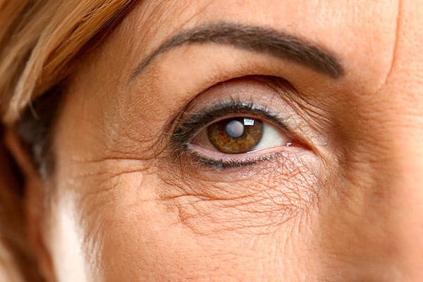 regarder ecran apres operation de la cataracte antony dr kaswin ophtalmologue specialiste chirurgie refractive cataracte